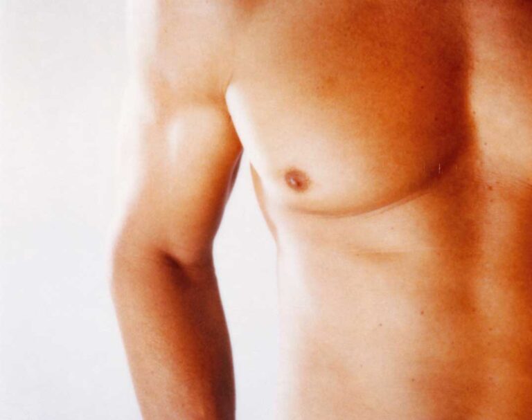 Gynecomastia Surgery In Dubai