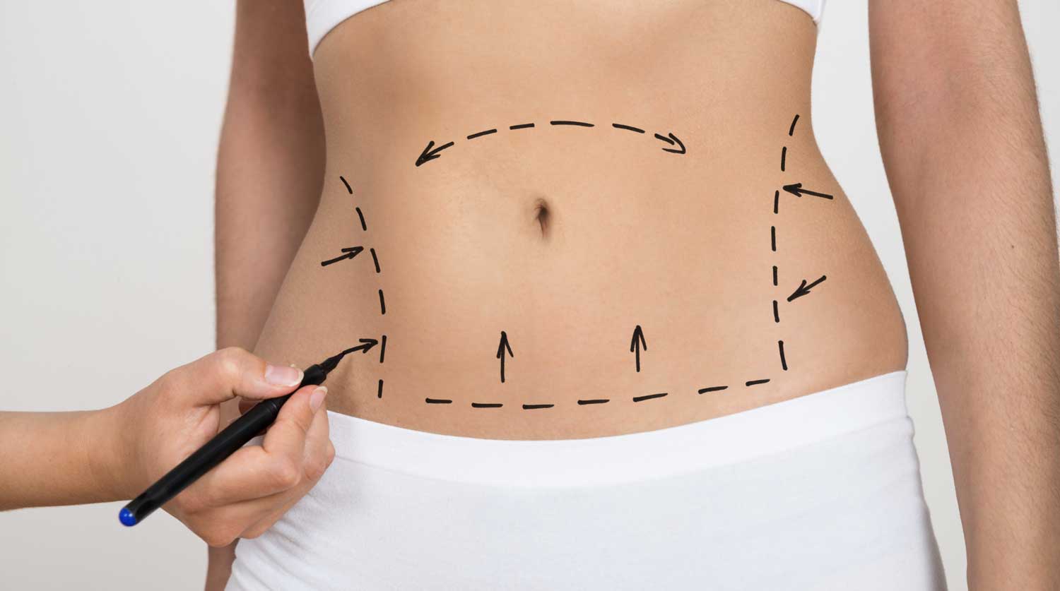 What's the difference between mini tummy tuck (mini-abdominoplasty