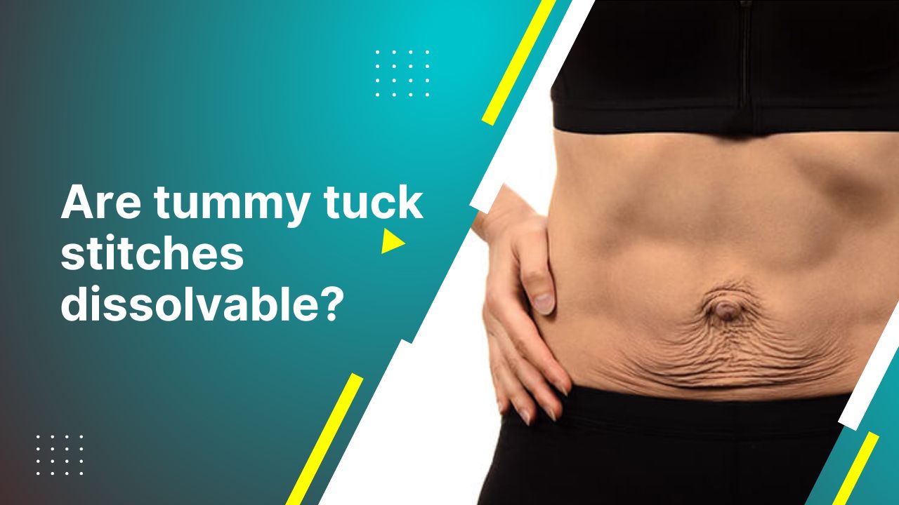 Are Tummy Tuck Stitches Dissolvable? 2024