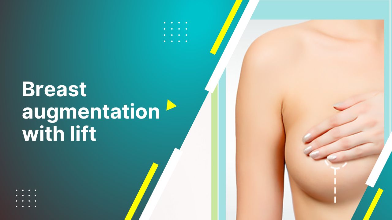 Breast Augmentation With Lift  Benefits Of Breast Augmentation