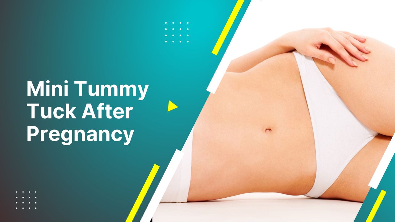What Is Tummy Tuck Revision?  Are Tummy Tuck Revision Free 2024