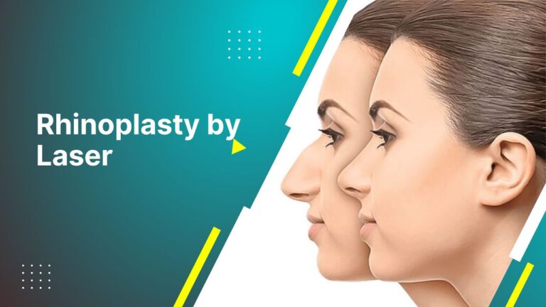 Rhinoplasty By Laser