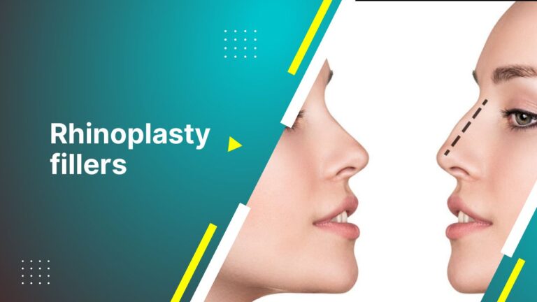 Rhinoplasty Fillers