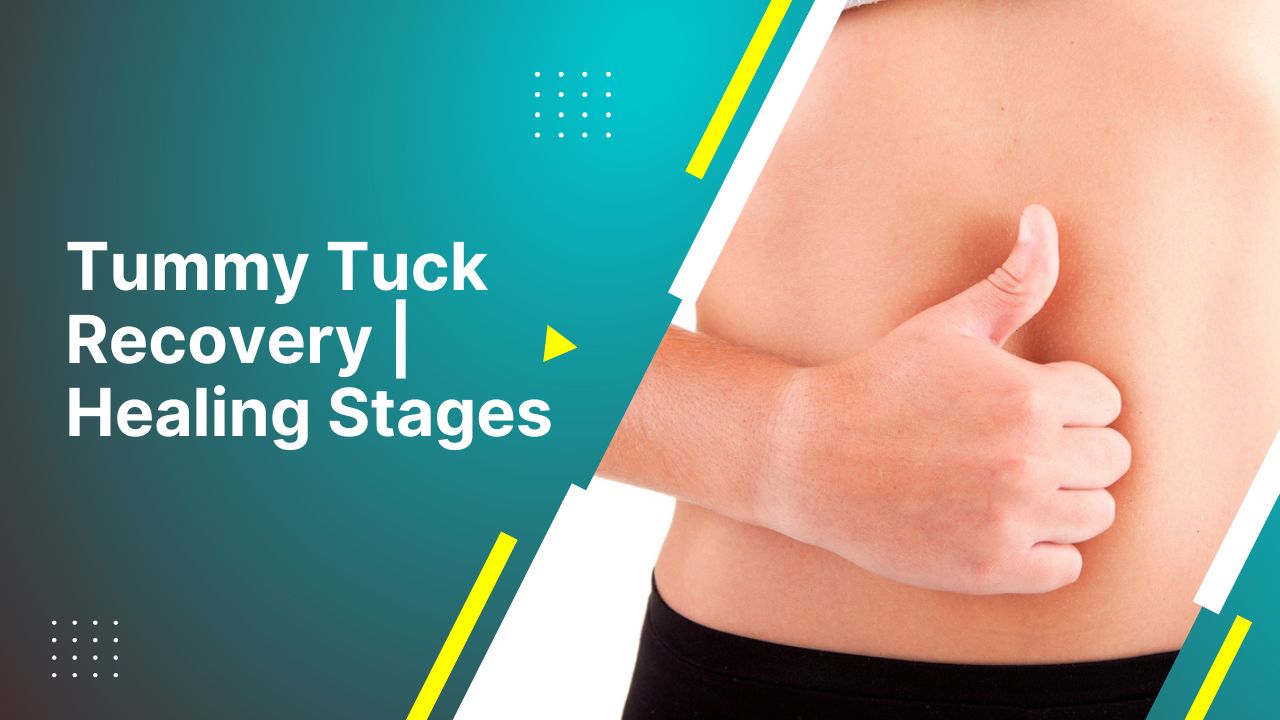 4 Simple Tips for Your Drainless Tummy Tuck Recovery - Harley Clinic