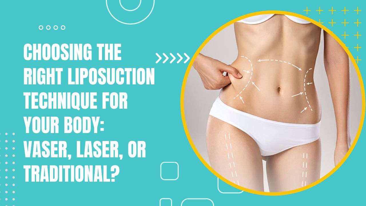 VASER Hi-Definition Arm Liposuction Can Save You Years At The Gym