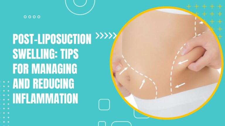 Post Liposuction Swelling Tips For Managing And Reducing Inflammation