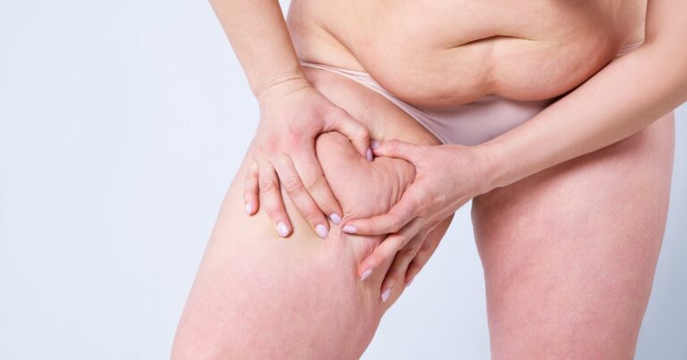 Thigh Liposuction_