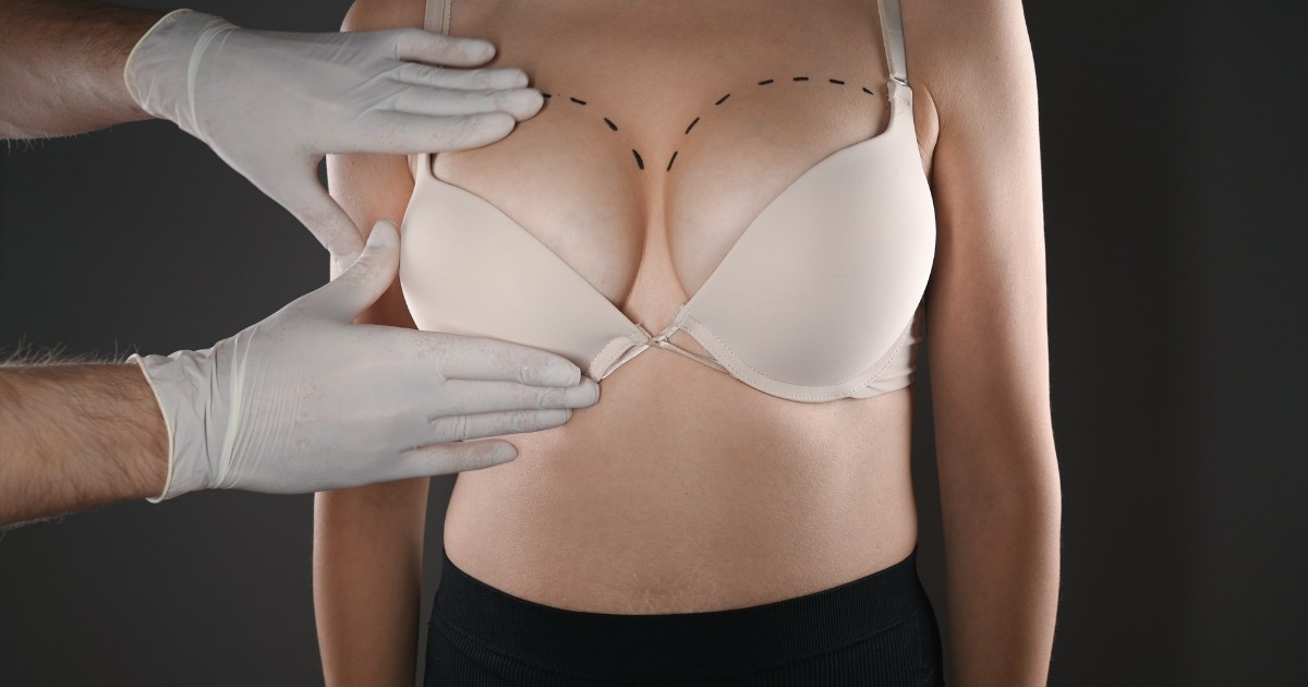 From a DD Cup to a B Cup Without Scars – Scareless Breast Surgery