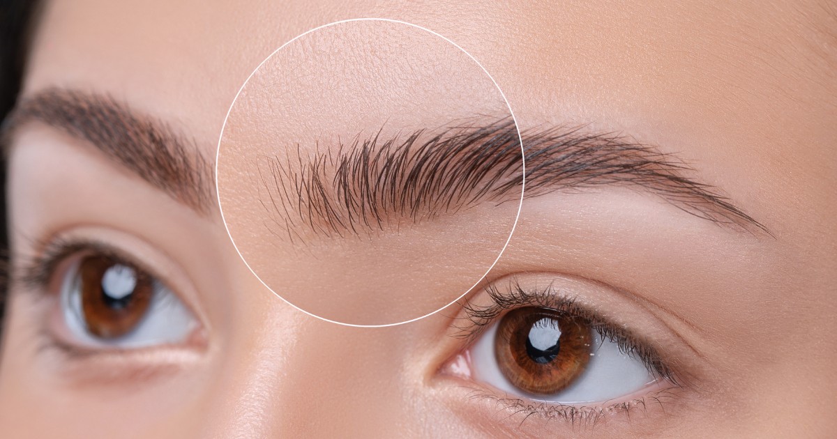 Can Botox Even Out Eyebrows: What You Need To Know 2024