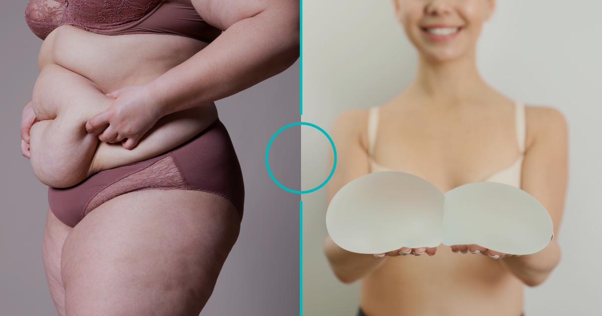 Essential Things to Know Before Getting Body Contouring Surgery