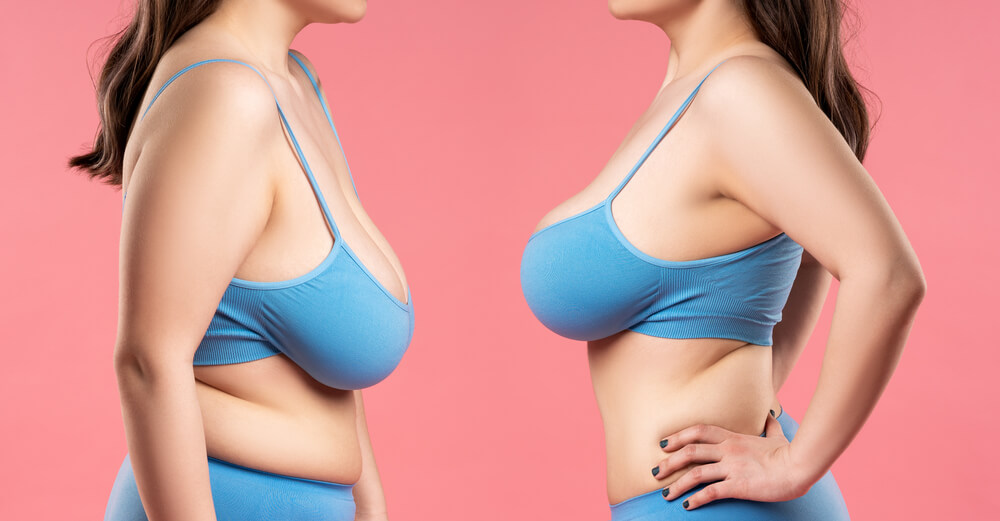 7 Ways to Lift Sagging Breasts