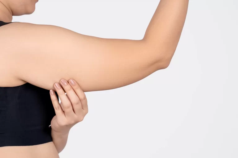 Is Arm Liposuction Worth It