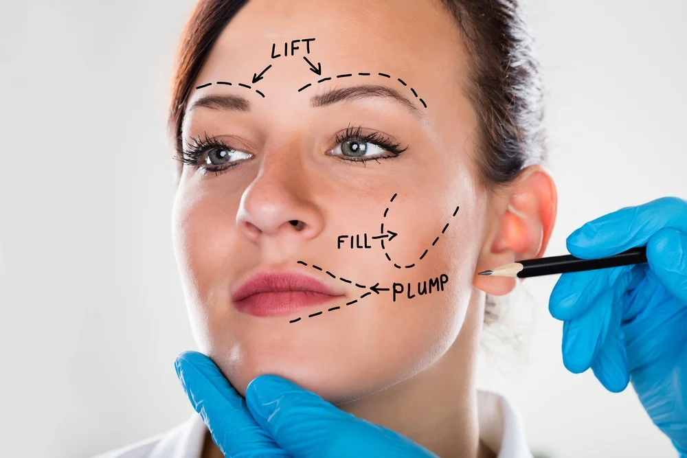 Facelift Surgery What Is It