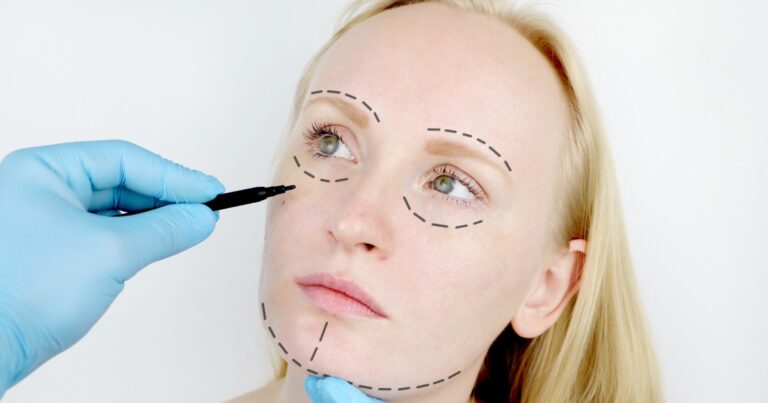 Facelift Plastic Surgeon Near Me 1