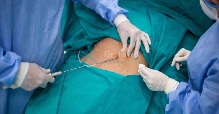 Is Liposuction A Safe Procedure