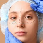 Plastic Surgeon Eye Lift - Dr. Tarek