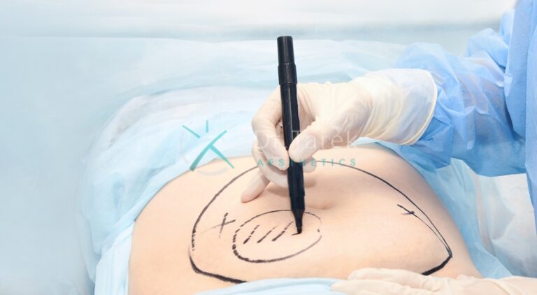 What Does Liposuction Do