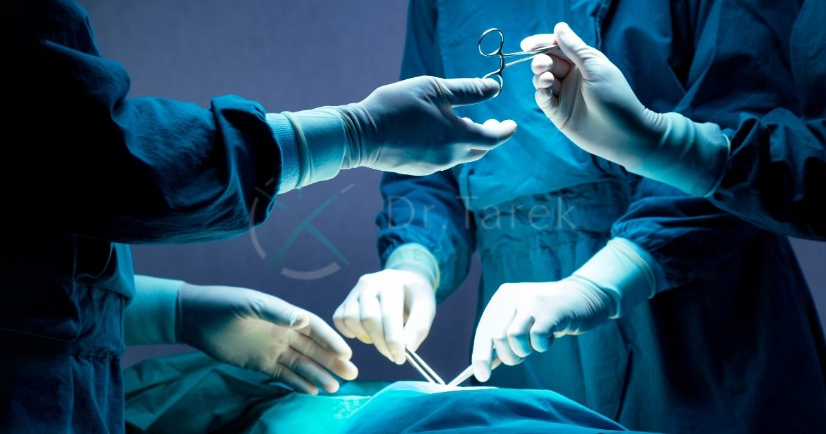 Can A General Surgeon Do Liposuction