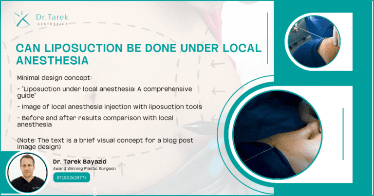 Can Liposuction Be Done Under Local Anesthesia