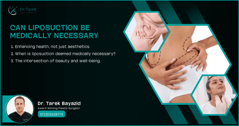 Can Liposuction Be Medically Necessary