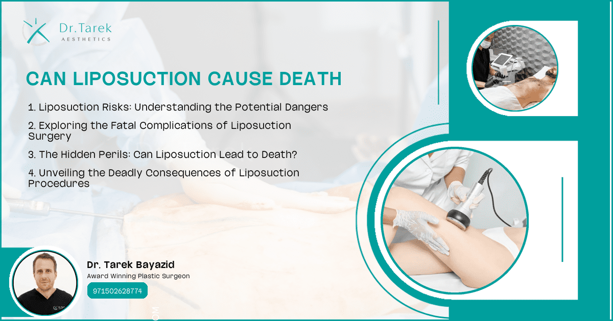 Can Liposuction Cause Death