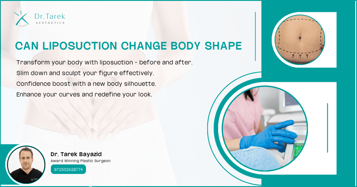 Can Liposuction Change Body Shape