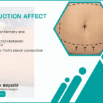 Does Liposuction Affect Fertility When Do You Need Eyelid Surgery