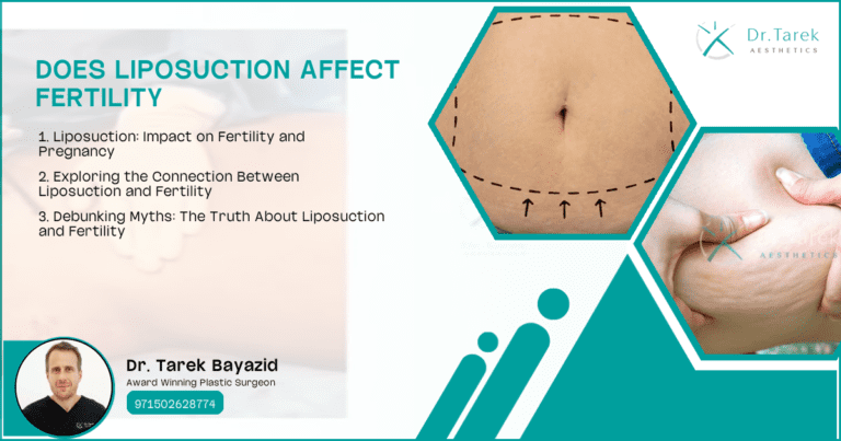 Does Liposuction Affect Fertility