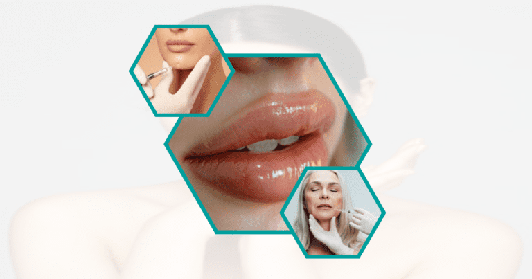 10 Essential Aftercare Tips For Lip Fillers: