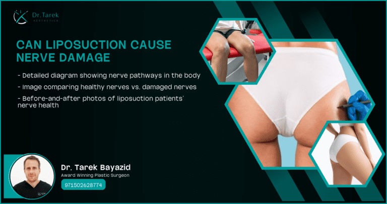 Can-Liposuction-Cause-Nerve-Damage