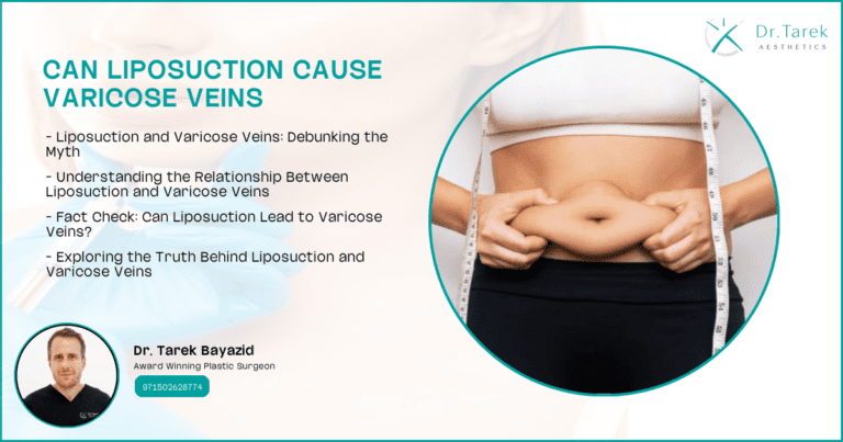 Can Liposuction Cause Varicose Veins