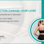 Can Liposuction Damage Your Liver