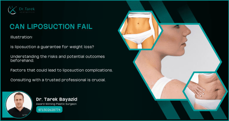 Can Liposuction Fail