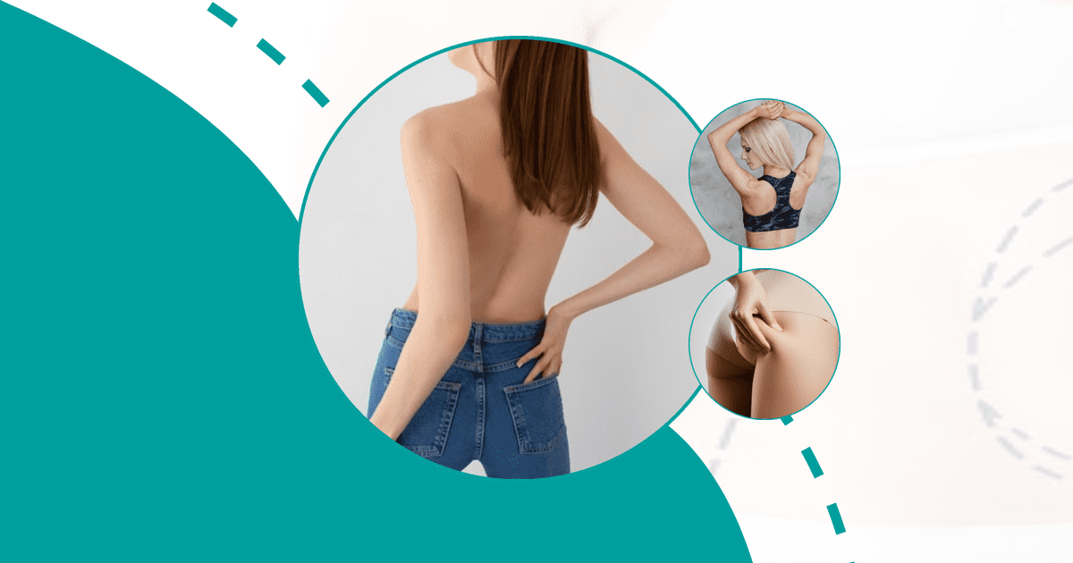 Can Liposuction Cause Fat Embolism