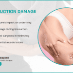 Does Liposuction Damage Muscle