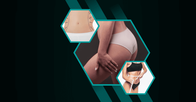 Will-Liposuction-Get-Rid-Of-Belly-Fat