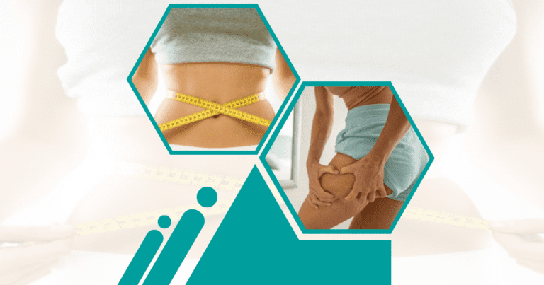 Can-Liposuction-Jump-Start-Weight-Loss