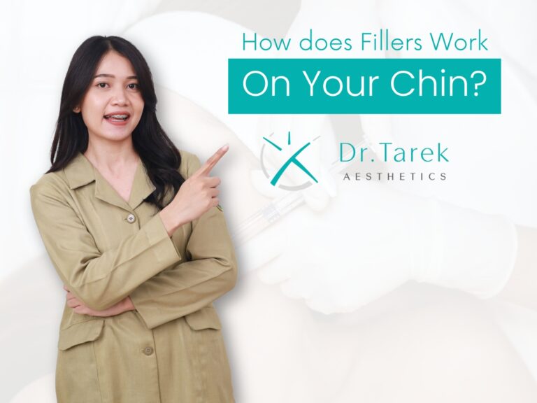 How Does Fillers Work On Your Chin?